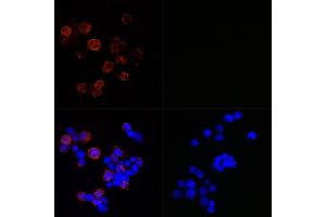 Immunofluorescence analysis of 293T-N and 293T cells using SARS-CoV-2 Nucleoprotein Rabbit mAb (ABIN7269052) at dilution of 1:100,1:400,1:1600,1:3200 (40x lens). (Nucleoprotein anticorps)