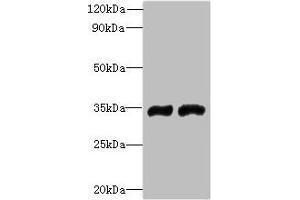 Western blot All lanes: FYTTD1 antibody at 4 μg/mL Lane 1: A375 whole cell lysate Lane 2: Jurkat whole cell lysate Secondary Goat polyclonal to rabbit IgG at 1/10000 dilution Predicted band size: 36, 34, 29, 15 kDa Observed band size: 36 kDa (FYTTD1 anticorps  (AA 1-318))