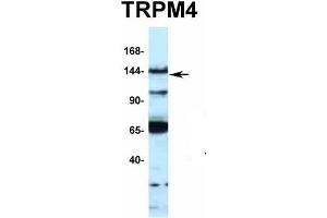 Host:  Rabbit  Target Name:  TRPM4  Sample Type:  MCF7  Antibody Dilution:  1.