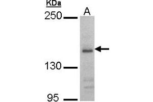 Western Blotting (WB) image for anti-Glutamate Receptor, Ionotropic, N-Methyl D-Aspartate 2B (GRIN2B) (AA 1010-1259) antibody (ABIN467519) (GRIN2B anticorps  (AA 1010-1259))
