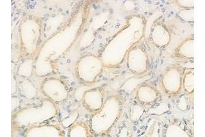 anti-OR2T2/2T35 antibody