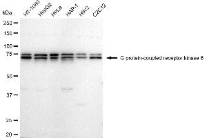 Western blotting analysis using G protein-coupled receptor kinase 6 antibody (ABIN7798674).
