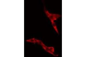 ABIN6275488 staining A549 cells by IF/ICC. (ARHGDIG anticorps  (Internal Region))