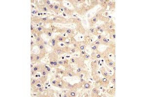 (ABIN659060 and ABIN2838063) staining PDK2 in human liver sections by Immunohistochemistry (IHC-P - paraformaldehyde-fixed, paraffin-embedded sections). (PDK2 anticorps)
