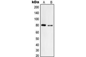 Western blot analysis of Tyrosinase expression in A375 (A), HepG2 (B) whole cell lysates. (TYR anticorps  (C-Term))