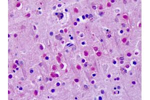 Anti-ROR Alpha / RORA antibody IHC of human brain, cortex.
