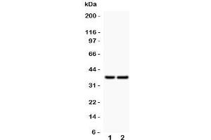 Western blot testing of CD79a antibody and Lane 1:  human placenta;  2: rat spleen; Predicted/Observed molecular weight: 25~47 kDa depending on glycosylation level (CD79a anticorps  (AA 121-226))