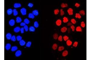 IF analysis of Histone H1. (Histone H1 anticorps  (AA 20-159))