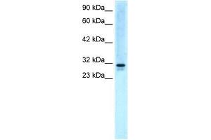 Western Blot showing EAP30 antibody used at a concentration of 5. (SNF8 anticorps  (N-Term))