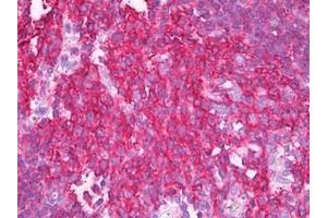 Tonsil stained in IHC-P with SNAP23 antibody