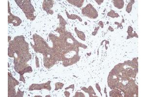 Image no. 3 for anti-Chemokine (C-X-C Motif) Ligand 10 (CXCL10) antibody (ABIN465012) (CXCL10 anticorps)