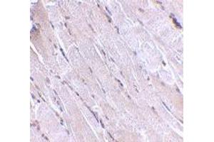 Immunohistochemistry of WNT10B in human skeletal muscle with WNT10B polyclonal antibody  at 2. (WNT10B anticorps  (Internal Region))