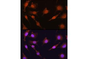 Immunofluorescence analysis of L929 cells using PRMT5 Rabbit pAb (ABIN3022065, ABIN3022066, ABIN3022067 and ABIN6218592) at dilution of 100 (40x lens).