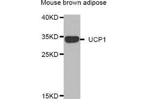 Western blot analysis of extracts of mouse brown adipose, using UCP1 antibody (ABIN5974361). (UCP1 anticorps)