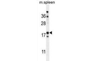 Western Blotting (WB) image for anti-Retinol Binding Protein 7, Cellular (RBP7) antibody (ABIN2999706) (RBP7 anticorps)