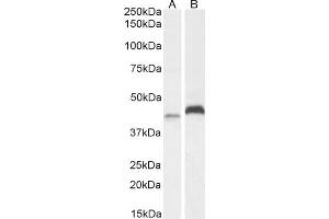 (ABIN184935) (2 μg/mL) staining of A431 (A) and HeLa (B) cell lysate (35 μg protein in RIPA buffer). (RNF13 anticorps  (C-Term))