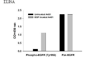 Image no. 3 for Epidermal Growth Factor Receptor (EGFR) ELISA Kit (ABIN625225) (EGFR Kit ELISA)