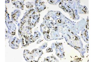 IHC analysis of HBD using anti-HBD antibody .