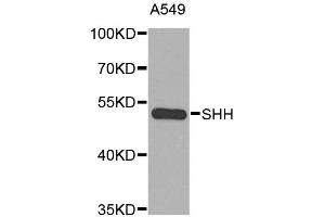 Western blot analysis of extracts of A-549 cells, using SHH antibody. (Sonic Hedgehog anticorps)