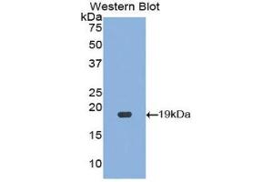 Western Blotting (WB) image for anti-Hypoxia Inducible Factor 1, alpha Subunit (Basic Helix-Loop-Helix Transcription Factor) (HIF1A) (AA 238-389) antibody (ABIN1859150)