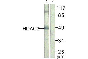 Immunohistochemistry analysis of paraffin-embedded human skin tissue, using HDAC3 (Ab-424) antibody. (HDAC3 anticorps)