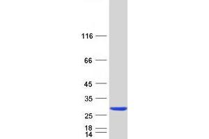 Validation with Western Blot