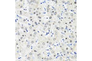 Immunohistochemistry of paraffin-embedded Human liver using TRIM27 antibody (ABIN7269922) at dilution of 1:100 (40x lens). (TRIM27 anticorps  (AA 1-200))