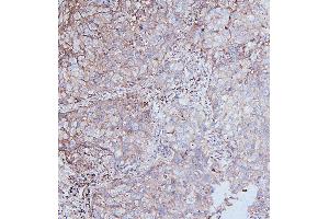 IHC analysis of DDR1 using anti-DDR1 antibody (ABIN7601407). (DDR1 anticorps  (AA 341-909))