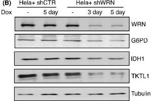 Werner syndrome protein (WRN) depletion alters the levels of metabolic enzymes. (Glucose-6-Phosphate Dehydrogenase anticorps)