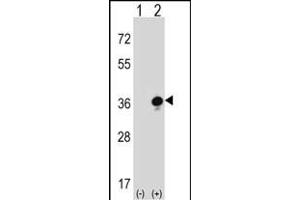 Western blot analysis of GZMB (arrow) using rabbit polyclonal GZMB Antibody (C-term) (ABIN390496 and ABIN2840855).