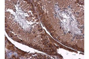 IHC-P Image ZO-1 antibody [N1N2], N-term detects ZO-1 protein at cell membrane and cytoplasm in mouse testis by immunohistochemical analysis.