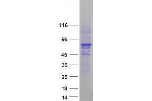 Validation with Western Blot