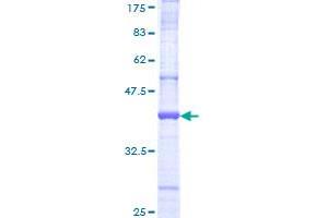 Image no. 1 for HECT Domain and Ankyrin Repeat Containing, E3 Ubiquitin Protein Ligase 1 (HACE1) (AA 800-909) protein (GST tag) (ABIN1306316)