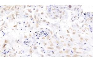 Detection of LHb in Human Placenta Tissue using Monoclonal Antibody to Luteinizing Hormone Beta Polypeptide (LHb)