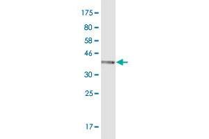 Western Blot detection against Immunogen (37.