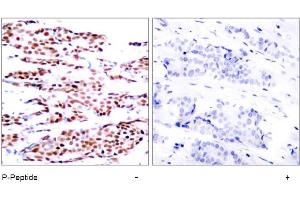 Image no. 1 for anti-Jun B Proto-Oncogene (JUNB) (pSer79) antibody (ABIN196657) (JunB anticorps  (pSer79))