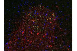 Indirect immunofluorescence labeling of PFA fixed, paraffin embedded mouse spinal cord section with anti-SV 31 (dilution 1 : 500; red) and guinea pig anti-VAchT (, dilution 1 : 500, green). (TMEM163 anticorps  (AA 44-63))