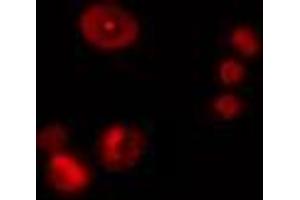 ABIN6274476 staining Hela cells by IF/ICC. (ZNF668 anticorps  (Internal Region))