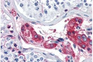 Human Testis (formalin-fixed, paraffin-embedded) stained with F12 antibody ABIN364435 at 5 ug/ml followed by biotinylated anti-goat IgG secondary antibody ABIN481715, alkaline phosphatase-streptavidin and chromogen.