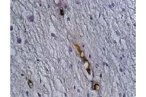 Immunohistochemistry (IHC) image for anti-Synaptophysin (SYP) antibody (ABIN1109181)