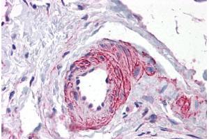 Human Vessel: Formalin-Fixed, Paraffin-Embedded (FFPE)