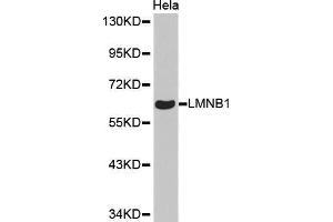 Western Blotting (WB) image for anti-Lamin B1 (LMNB1) antibody (ABIN1513160) (Lamin B1 anticorps)