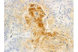 anti-Keratin 35 (KRT35) (C-Term) antibody