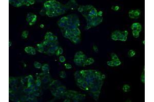 Image no. 6 for anti-L1 Cell Adhesion Molecule (L1CAM) antibody (ABIN1499088) (L1CAM anticorps)