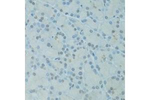 Immunohistochemistry of paraffin-embedded rat pancreas using GTF2H2C antibody  at dilution of 1:100 (40x lens). (GTF2H2C anticorps  (AA 1-300))