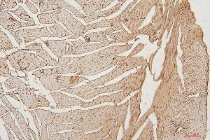IHC analysis of PPCS using anti-PPCS antibody (ABIN7602752). (PPCS anticorps  (C-Term))