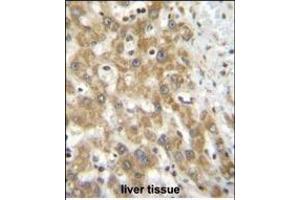 NPS3A Antibody (Center) (ABIN655107 and ABIN2844739) immunohistochemistry analysis in formalin fixed and paraffin embedded human liver tissue followed by peroxidase conjugation of the secondary antibody and DAB staining.