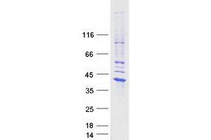 Validation with Western Blot