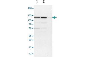 Western blot anyalysis of Lane 1: NIH-3T3 cell lysate (Mouse embryonic fibroblast cells), Lane 2: NBT-II cell lysate (Rat Wistar bladder tumour cells), Lane 3: PC12 cell lysate (Pheochromocytoma of rat adrenal medulla) with NCAPH polyclonal antibody . (NCAPH anticorps)
