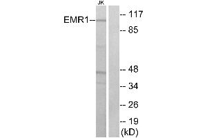 Western blot analysis of extracts from Jurkat cells, using EMR1 antibody.